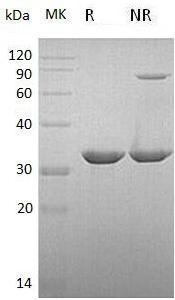 Human B3GAT3 (His tag) recombinant protein