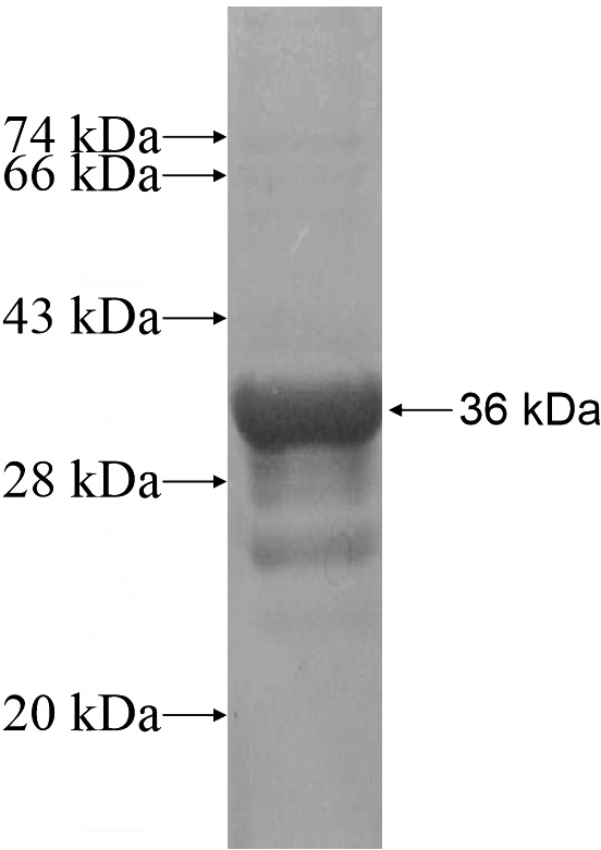 Recombinant Human LCE1B SDS-PAGE