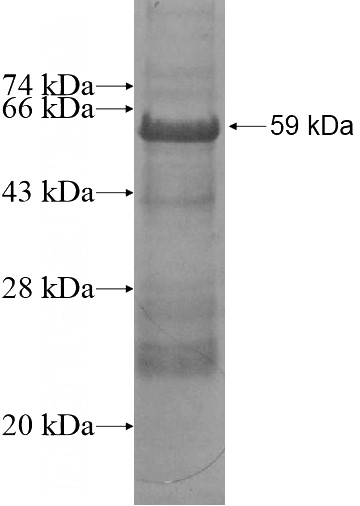Recombinant Human MXD1 SDS-PAGE