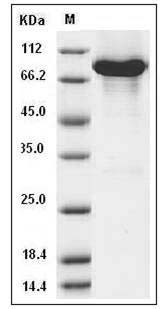 Human KEAP1 / INRF2 Protein (His & GST & AVI Tag) SDS-PAGE