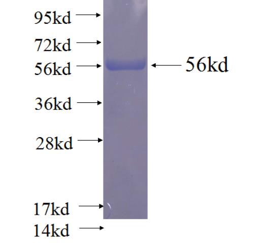 Recombinant human STOML2 SDS-PAGE