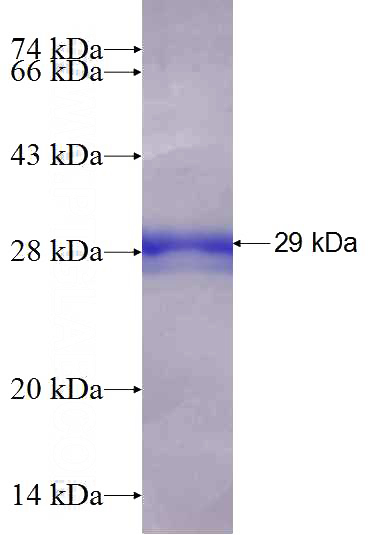 Recombinant Human FXN SDS-PAGE