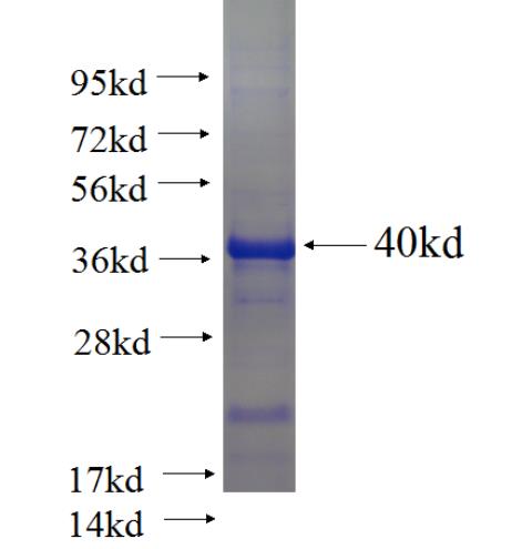 Recombinant human CYB5R3 SDS-PAGE