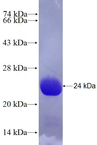 Recombinant Human CEND1 SDS-PAGE
