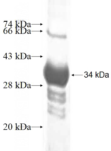 Recombinant Human MED6 SDS-PAGE