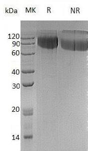 Human GPNMB/HGFIN/NMB/UNQ1725/PRO9925 (His tag) recombinant protein