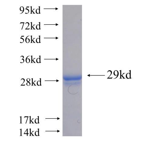 Recombinant human MED20(Full length) SDS-PAGE