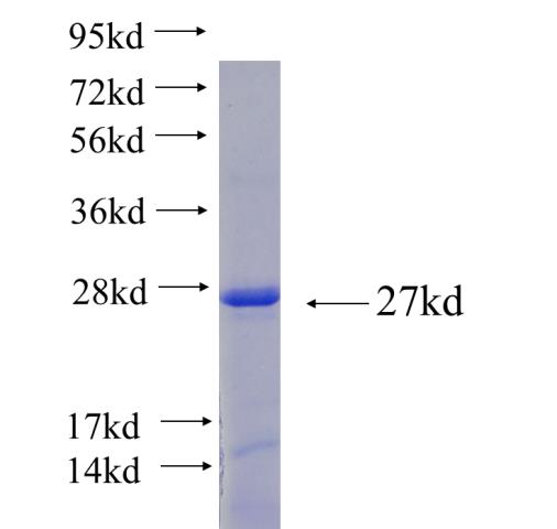 Recombinant human GOSR2 SDS-PAGE