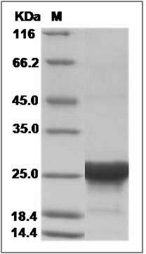 Human RAB31 / Rab22B Protein (His Tag) SDS-PAGE