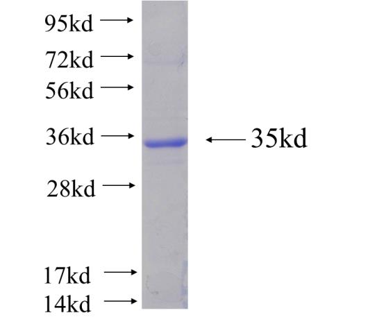 Recombinant human ST3GAL5 SDS-PAGE