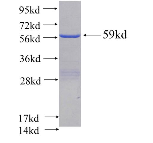 Recombinant human M6PRBP1 SDS-PAGE