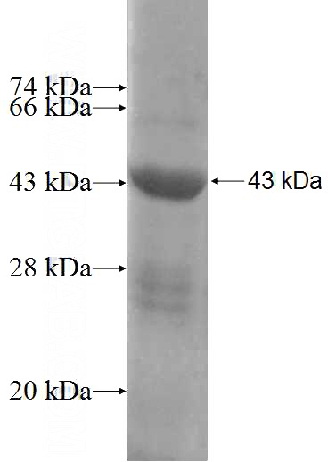 Recombinant Human H6PD SDS-PAGE