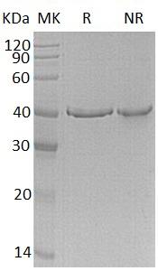 Human GMPR/GMPR1 (His tag) recombinant protein