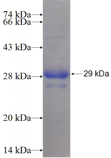 Recombinant Human DCTN6 SDS-PAGE