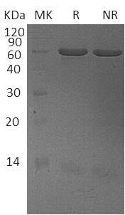 Bovine PDIA3 (His tag) recombinant protein