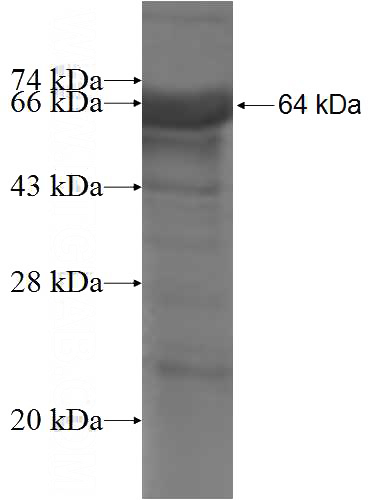 Recombinant Human MEF2D SDS-PAGE