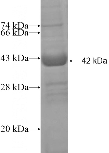 Recombinant Human FAM72A SDS-PAGE