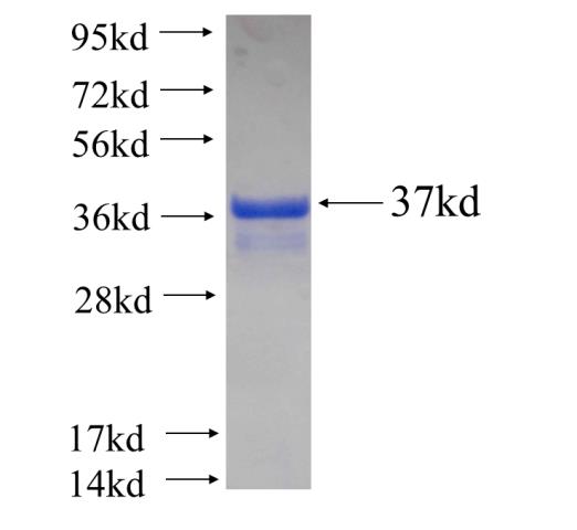 Recombinant human ACTL7A SDS-PAGE