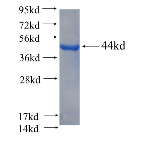 Recombinant human ZSCAN20 SDS-PAGE