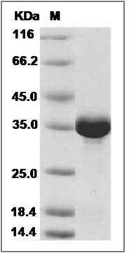 Human NUDT5 / ADP-sugar Pyrophosphatase Protein (His Tag) SDS-PAGE