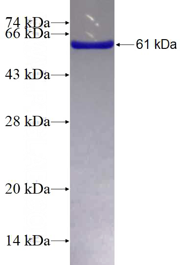 Recombinant Human PRPS1 SDS-PAGE