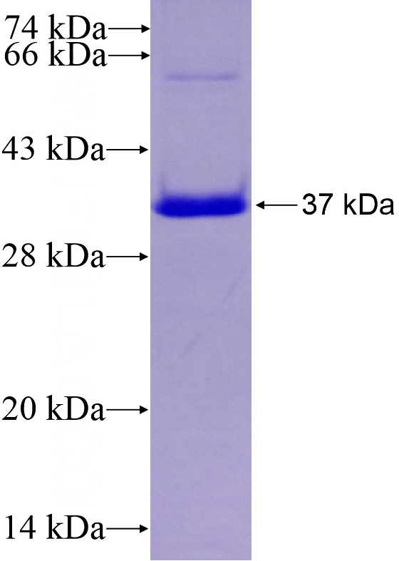 Recombinant Human SP6 SDS-PAGE