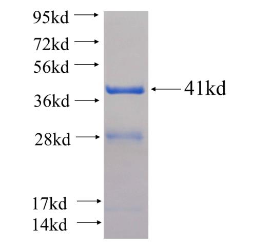 Recombinant human CPLX1 SDS-PAGE