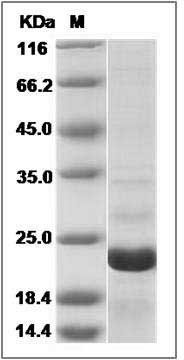 Human EIF5A2 Protein (His Tag) SDS-PAGE