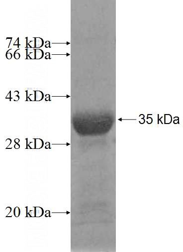 Recombinant Human NUS1 SDS-PAGE