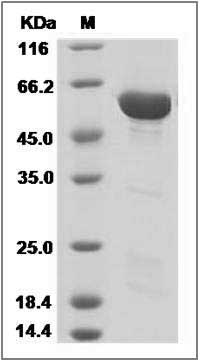 Human MAB21L2 Protein (His & ZZ Tag) SDS-PAGE