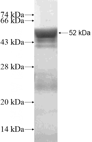 Recombinant Human SPAST SDS-PAGE