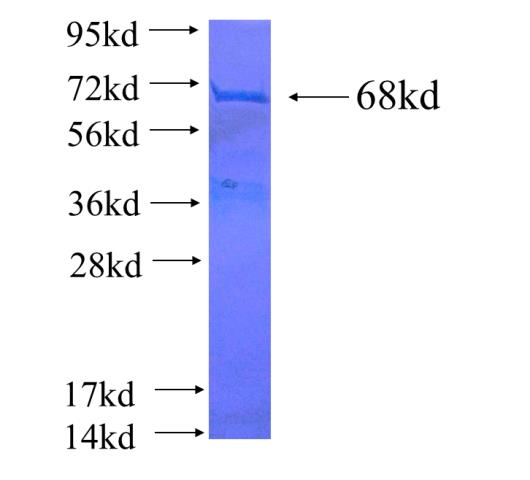 Recombinant human ARFIP1(Full length) SDS-PAGE