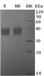 Mouse Ca12/Car12 (His tag) recombinant protein