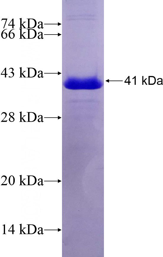 Recombinant Human COL6A2 SDS-PAGE