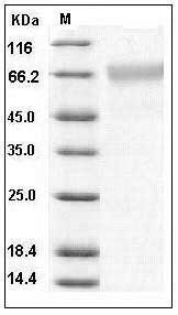 Human BACE1 / ASP2 Protein SDS-PAGE