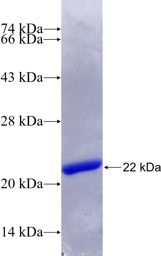 Recombinant Human FREQ SDS-PAGE