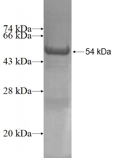 Recombinant Human GSTT2 SDS-PAGE