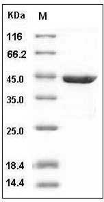 Human RAC1 / MIG5 Protein (GST Tag) SDS-PAGE