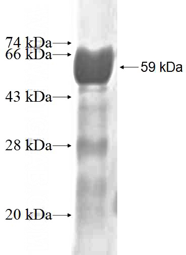Recombinant Human TRIM6 SDS-PAGE