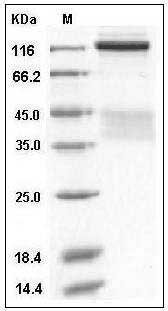 Human Insulin Receptor / INSR / CD220 Protein (short isoform, His Tag) SDS-PAGE