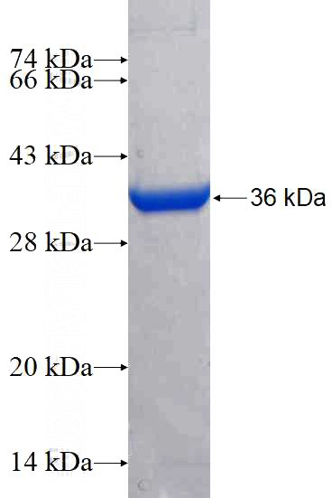 Recombinant Human OAS3 SDS-PAGE