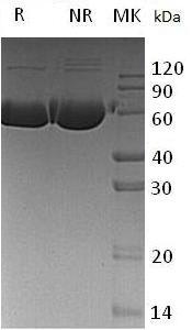 Human ARSA (His tag) recombinant protein