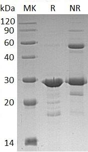 Human GRB2/ASH (His tag) recombinant protein