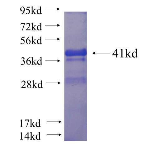 Recombinant human LYSMD3 SDS-PAGE