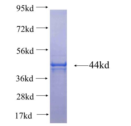 Recombinant human TRIM38 SDS-PAGE