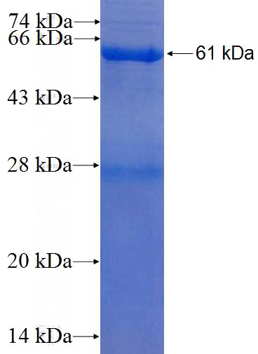 Recombinant Human PCTK3 SDS-PAGE