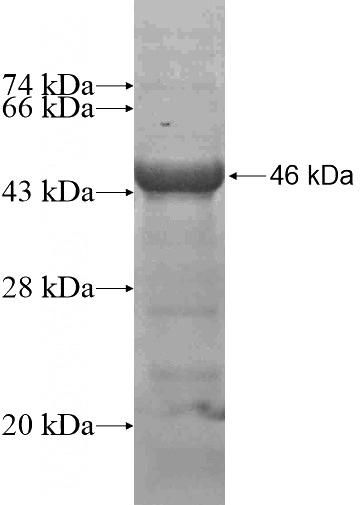 Recombinant Human MEF2D SDS-PAGE