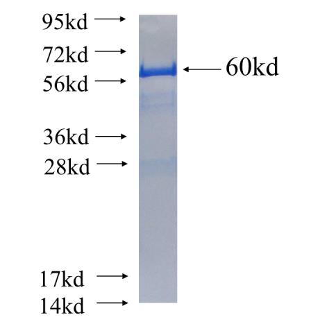 Recombinant human STAM2 SDS-PAGE