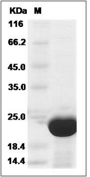 Human COMMD8 Protein (His Tag) SDS-PAGE
