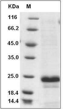 Human CD20 / MS4A1 Protein (aa 213-297, His Tag) SDS-PAGE